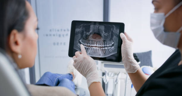 Licensed Root Canal Treatment service in Woodville, OH - Smile Center Dentistry